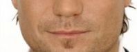 BL_Nose-to-mouth_After_300x115.jpg BL_Nose-to-mouth_After_300x115.jpg
